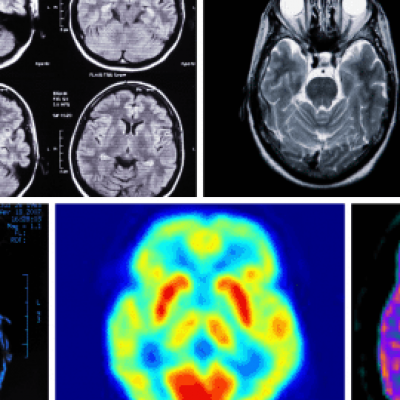Ct Scan