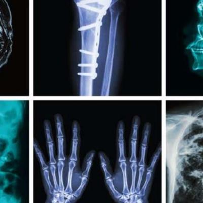 X- Ray