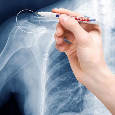 X Ray Marker