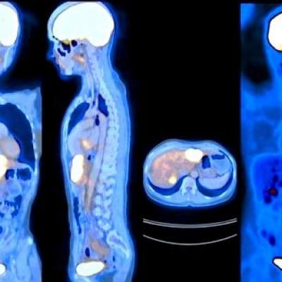 nuclear-medicine