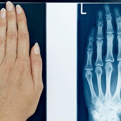 X Ray