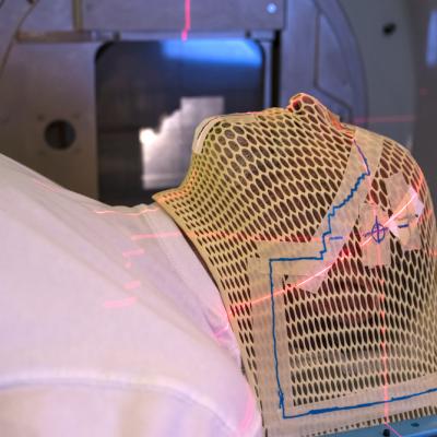 radiotherapy