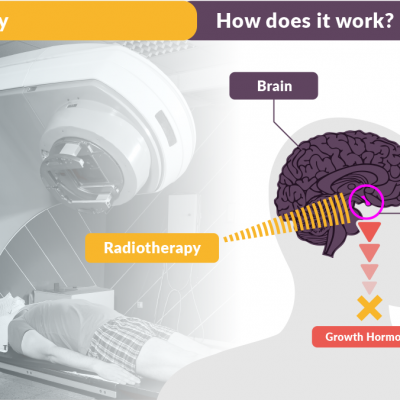 Radiotherapy