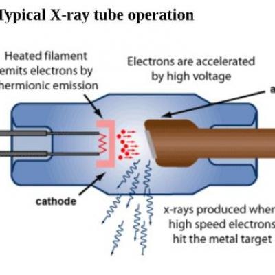 X-Ray