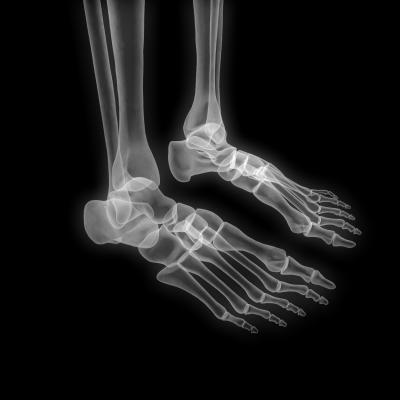 X-ray