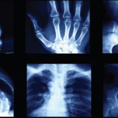 X-Ray