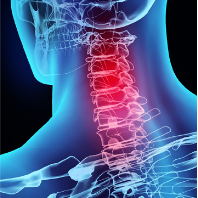 X- Ray06