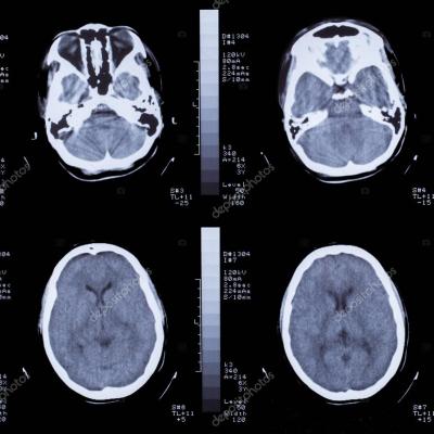 (CT) scan 02