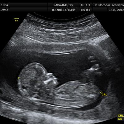 Ultrasound03