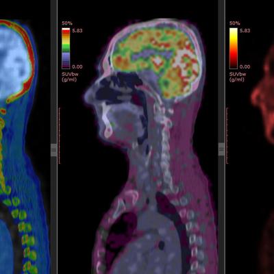 Nuclear medicine02